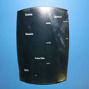DISPLAY COVER, V100, SPO2/BP -ENG DISPLAY COVER, V100, SPO2/BP -ENG
